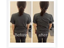 トトノウ 自由が丘店(totonou)/Before after (22) 