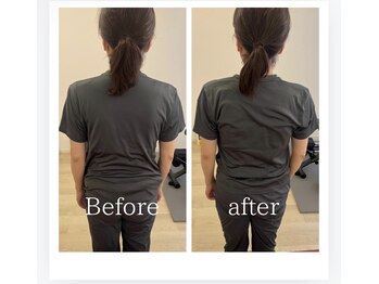 トトノウ 自由が丘店(totonou)/Before after (22)