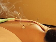 よもぎ堂 飯田橋/鍼灸/マッサージ/肩こり[飯田橋]