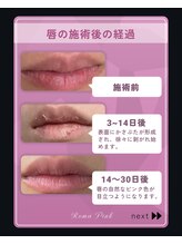 エピス(Epice)/ローマピンク（唇）