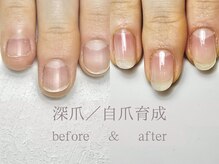 ル リアン 北浦和(le lien)/深爪育成(10ヶ月／9回)