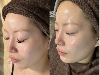 セルヴィノバ(CELL VI NOVA)/＊ビフォーアフター