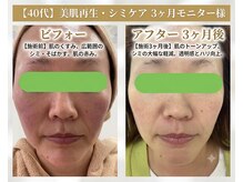 オリーブ(Olive)の雰囲気（40代　肌色の赤みとくすみ　透明感のある肌色に／毛穴　美白）