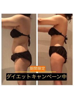 ミディースパ(Middy SPA)/夏のキャンペーン