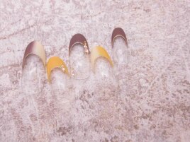 (2000)縦グラフレンチ