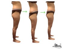 エステサロン ジュブリー/［痩身、お腹、太もも］