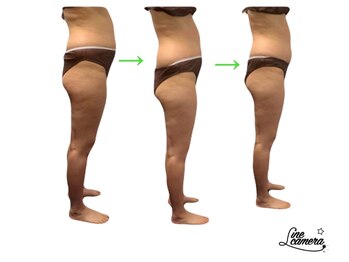 エステサロン ジュブリー/［痩身、お腹、太もも］