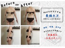 サロンデュ ひゃーく(Salon du ひゃーく)/3回で骨盤６センチ減！結果重視