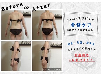 サロンデュ ひゃーく(Salon du ひゃーく)/3回で骨盤６センチ減！結果重視