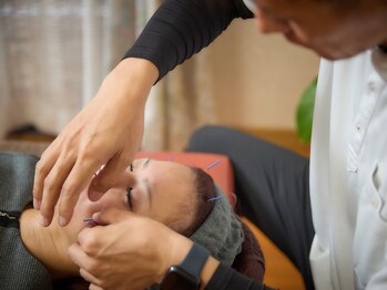 鍼灸整体ラクーナ/施術の様子１