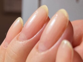 キュア(Cure.)の写真/【深爪・反り爪改善／巻き爪矯正／美爪ケア】解決・緩和・育成を美爪クリエイターがお手伝いたします◇