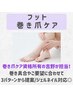 吉野担当☆フット巻き爪矯正【3パターンから爪に合わせてご提案】/1本¥6600