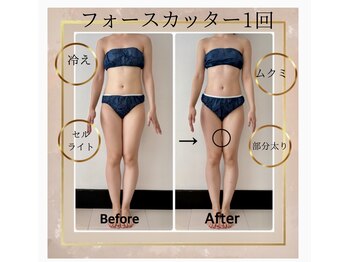 レアーレグロウ(Reale Glow)/Before→After