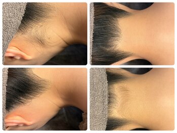 サロン エム(saron M)の写真/安心の都度払いで脱毛で綺麗なうなじを手に入れる！美しい後ろ姿の準備を◎