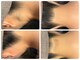 サロン エム(saron M)の写真/安心の都度払いで脱毛で綺麗なうなじを手に入れる！美しい後ろ姿の準備を◎