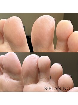 ☆最新☆韓国式角質除去