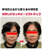 哲心 姫路/顔の左右差が改善しました♪