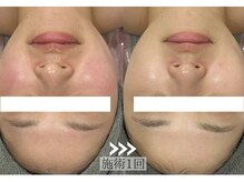 リライン(ReLine)の雰囲気（お客様1人1人のお悩みに合ったメニューをご案内♪）