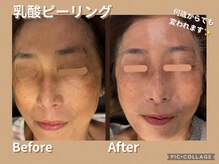 ボディリカバリー(Bodyリカバリー)/