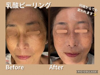 ボディリカバリー(Bodyリカバリー)/