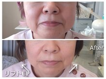 エタニティ(Eternity)/結果重視