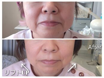 エタニティ(Eternity)/結果重視