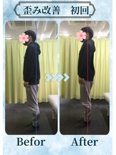 アミーゴ整体院/ビフォーアフター