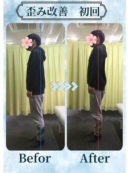 アミーゴ整体院/ビフォーアフター