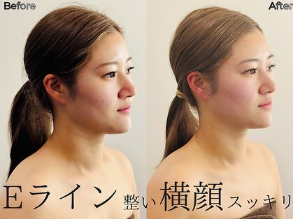 リストアハート(Restore Heart)の写真
