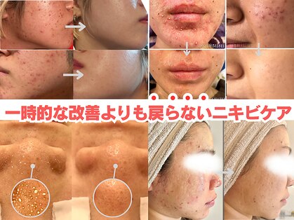 アイデアル(AiDEAL)の写真