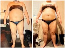 パーフェクトボディプレミアム 札幌駅前店(PERFECT BODY PREMIUM)/お客様　ビフォーアフター（27）