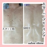 サロンシャイン(Salon Shine)