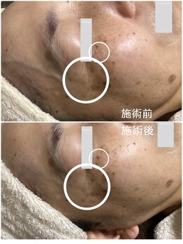 ブライトリー(Brightly)/ハリツヤ弾力のあるお肌に!