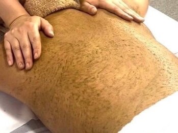 透肌美(トウキビ)の写真/特別な一日を自分史上最高の姿で☆背中/二の腕のハーブピーリング＊ドレス姿に自信が持てる美背中に♪