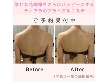 ティアラ(Tiara)の雰囲気（【ブライダル】最大限の魅力を引き出し花嫁様の想いを叶えます）
