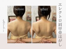 オートクチュール エステティックサロン シーズ/エレクトロ肩甲骨剥がし