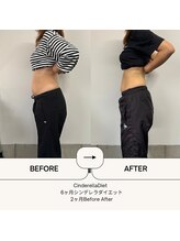 オーシャン整骨院(OCEAN整骨院)/６ヶ月コース