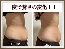 ムム(MooMoo)の雰囲気（痩身エステ/一度で効果あり！！結果重視サロン★）