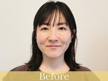 アントルーチェ 代々木上原(Entluce.)/ヒト臍帯幹細胞培養上清液