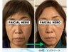 【過去小顔矯正に効果を感じれなかった方へ】本格小顔矯正＆巻き肩＆骨盤矯正