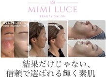 ミミルーチェ(mimiluce)