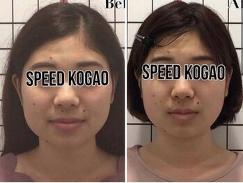 スピード小顔 渋谷店 (Speed)/圧倒的美人顔を造る技術