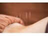 【再来】全身ととの鍼灸コース