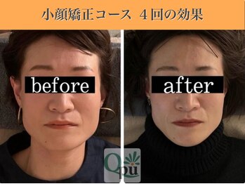 キュープ 表参道店(Qpu)/続けた方しか感じられない変化♪