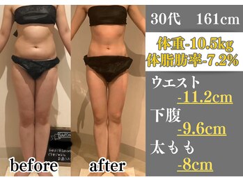 ラ コンシェル 町田店/Before After【町田店】