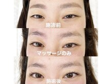 エニー 津田沼(eny)/ダブルアイリフト