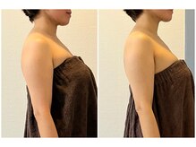 モア(moa)/症例写真