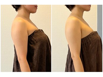 モア(moa)/症例写真