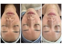 ミロク(369)/プラズマパワー