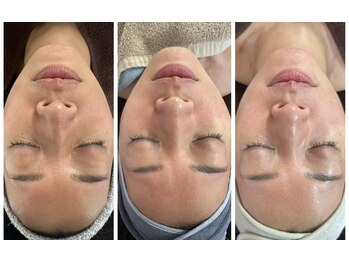 ミロク(369)/プラズマパワー